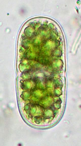 Actinotaenium americanum
